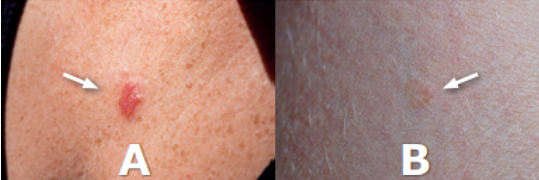 Bilderraetsel_Preventum